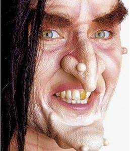 Woochie Stage Warts 3 PC