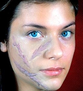 Woochie Scar Set 3PC