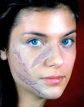 Woochie Scar Set 3PC